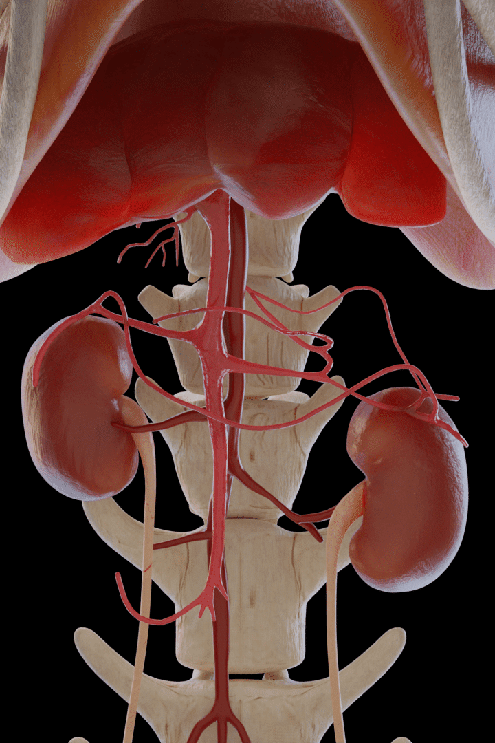 This is a 3D image of a canine liver shunt showing the liver, kidneys and other vessels.